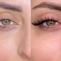 کراتین ... مژه