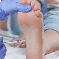 رفع تضمینی تعریق زیر بغل و کف دست|خدمات آرایشگری و زیبایی|تبریز, |دیوار