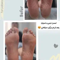 پدیکور پا|خدمات آرایشگری و زیبایی|بروجرد, |دیوار