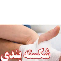 شکسته بندی ورگیری و درمان سیاتیک