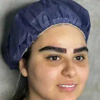 کاشت ابرو و مو