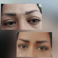 تاتودایم