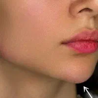 مرکز تخصصی ژل بوتاکس /کاشت امبدینگ لاغری در مطب|خدمات آرایشگری و زیبایی|کرمانشاه, |دیوار