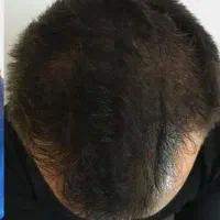 رویش مجدد لطفا راهنمایی کنید