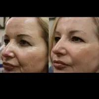 ضدچروک و چین گاتیو پخش رسمی|آرایشی، بهداشتی، درمانی|تهران, شهرک آتی شهر|دیوار