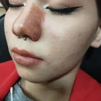 پلاسما .پلکسر|خدمات آرایشگری و زیبایی|زرند, |دیوار