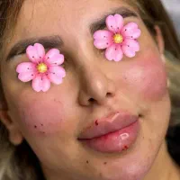 خدمات ژل بوتاکس آنزیم فیلر جوانساز مرو سر ابرو|خدمات آرایشگری و زیبایی|چهارباغ, |دیوار