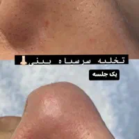 پاکسازی صورت ۲۵۰ تومن