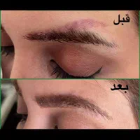 ریمو تتو.کربن ترابی صورت.روشن‌کردن نواحی تیره|خدمات آرایشگری و زیبایی|قم, باجک دو|دیوار
