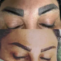 ریموو تخصصی تتو های قدیمی