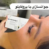 تخفیف استثنایی ژل و بوتاکس با شرایط پرداخت عالی|خدمات آرایشگری و زیبایی|آمل, |دیوار