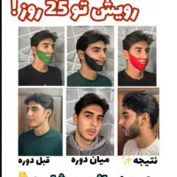 چسب ریش تضمینی