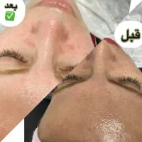 پاکسازی پوست و فشیال و لیفت ابرو ومژه|خدمات آرایشگری و زیبایی|سیاهکل, |دیوار