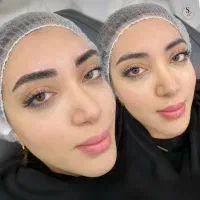 تخفیف ویژه آموزش وخدمات میکرو فیبروز شیدلب بن مژه