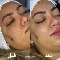 تخفیف پاییزه فیشال کلاسیک|خدمات آرایشگری و زیبایی|دوگنبدان, |دیوار