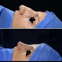 مطب زیبایی|خدمات آرایشگری و زیبایی|نورآباد, |دیوار