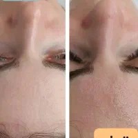 پاکسازی پوست