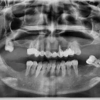 اسلاگ ساچمه پی سی پی تیر تفنگ بادی pcp|کوهنوردی و کمپینگ|سنندج, |دیوار