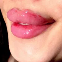 ژل لب رایگان