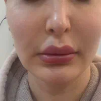 جوانساز پوست|خدمات آرایشگری و زیبایی|کرج, شهرک ظفر|دیوار