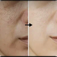 صابون روشن کننده و لایه بردار biz- پک ۳ عددی