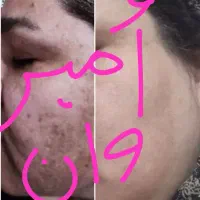 کرم صورت|آرایشی، بهداشتی، درمانی|شیراز, پانصد دستگاه ارتش|دیوار