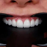 کامپوزیت دندانپزشکی تخفیفه ویژه اقساط چکی|خدمات آرایشگری و زیبایی|تهران, شهرک ولیعصر جنوبی|دیوار