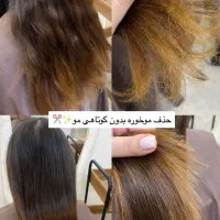 موخوره گیری، به صورت حرفه ای و تخفیف 50 درصدی