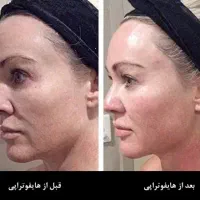 با ماهی ۷۹۵تومان کل صورتتو هایفو کن،اقایون وخانمها
