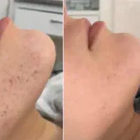 فیشیال