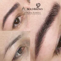 میکروبلیدینگ وشید لب روسی