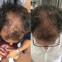 واجبی هم بریزی رو سرت بازم موهات درمیارم