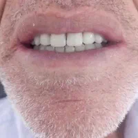 دندانسازی|آرایشی، بهداشتی، درمانی|فسا, |دیوار