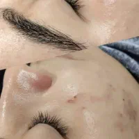 آفر خفن فشیال و پاکسازی
