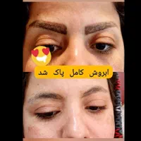کلینیک لیزرتتو ابرو،خط چشم،خط لب،ریموو،ریمو|خدمات آرایشگری و زیبایی|شیراز, فرهنگ شهر|دیوار