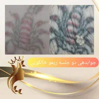 ریموو تتو با لیزر کیوسوئیچ و روشن سازی نواحی تیره|خدمات آرایشگری و زیبایی|قم, زنبیل آباد|دیوار