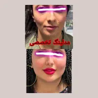 تزریق چربی. .مادلینگ .شکم .پهلو درکلینیک تخصصی|خدمات آرایشگری و زیبایی|کرمانشاه, |دیوار