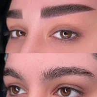 میکرو بلیدینگ.هیراستروک