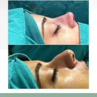 دندانپزشکی.کاشت مو.عمل بینی را دم قسط انجام بدهید|خدمات آرایشگری و زیبایی|بوشهر, |دیوار