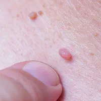 فقط با ۳۸۰تومن پاکشون کن