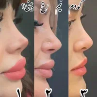 دنبال قیمت پایین هستید.این اگهی مناسب شما نیست