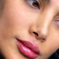 بوتاکس فیلرژل لب گونه چانه زاویه فک و صورت مادلینگ|خدمات آرایشگری و زیبایی|تهران, تهرانپارس غربی|دیوار