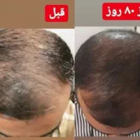 لوازم آرایشی بهداشتی،محصولات پوست ومووزیبایی|آرایشی، بهداشتی، درمانی|نجف‌آباد, طالقانی|دیوار