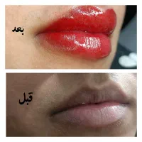 میکرو پگمتیشن با قیمت استثنایی فقط به مدت ده روز|خدمات آرایشگری و زیبایی|ساوه, |دیوار