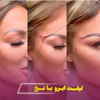 جشنواره لیفت فیلربوتاکس بلفارو نخ تزریق چربی فشیال|خدمات آرایشگری و زیبایی|اصفهان, ملکشهر|دیوار