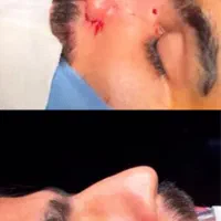 عمل بینی بندرعباس،اقساطی،باکیفیت و تضمین|خدمات آرایشگری و زیبایی|بندرعباس, |دیوار