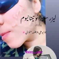 لیزر بانوان