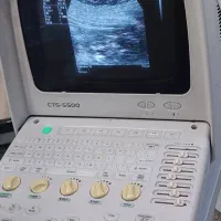 دستگاه سونوگرافی ۵۵۰۰سویی|آرایشی، بهداشتی، درمانی|تهران, باغ فیض|دیوار