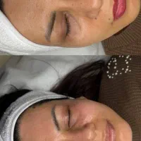 پاکسازی تخصصی پوست فقط با هزینه مواد