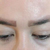 کاشت مو.و.ابرو درخرمدره